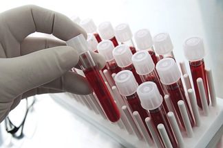 Расшифровка анализа крови эозинофилы понижены thumbnail