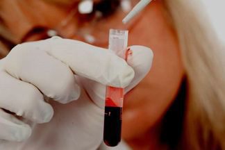 Биологический анализ крови расшифровка у взрослых норма в таблице thumbnail
