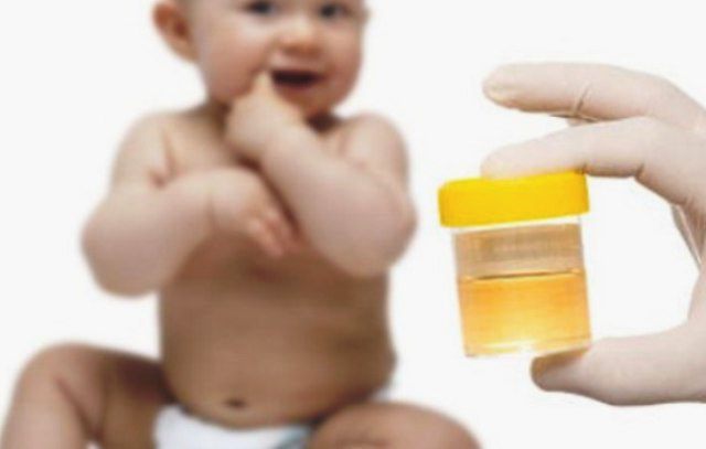 О чем говорит повышение лейкоцитов в моче ребенка